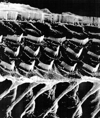 Inner and outer hair cell healthy
