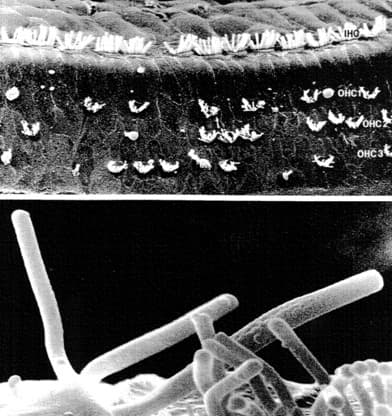 Outer and inner hair cell damaged and close up of damage