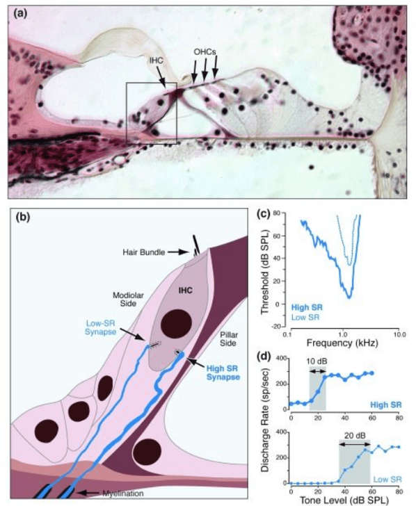 Type 1 nerve fibers diagram
