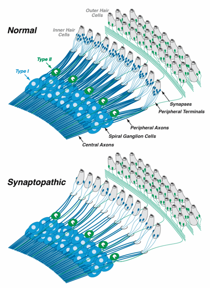 Spiral Ganglion Neurons diagram